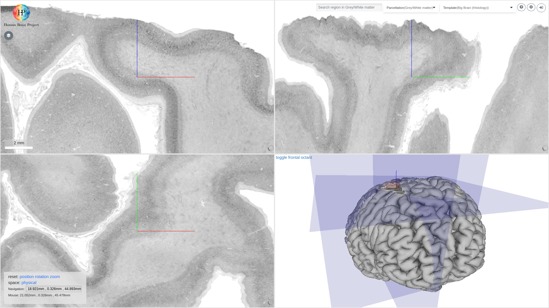 Preview of Big Brain 2015 Release